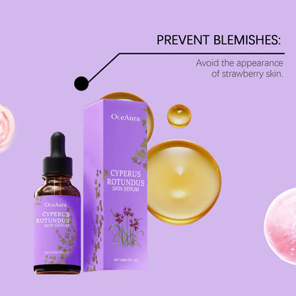 Cyperus Rotundus Oil